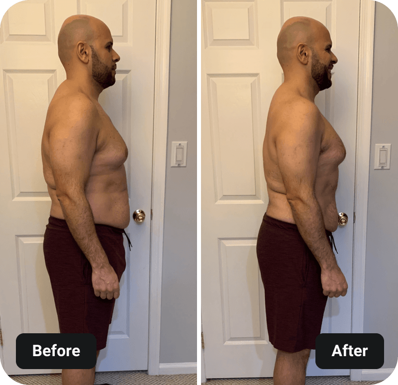 4 Week Gut Protocol Before and After